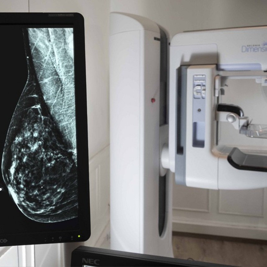 Salud: se realizarán mamografías y PAP gratuitos para prevenir enfermedades